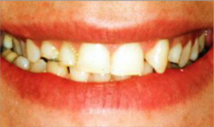 Ortodoncia e implantes