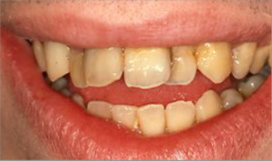Ortodoncia y rehabilitaciones estéticas