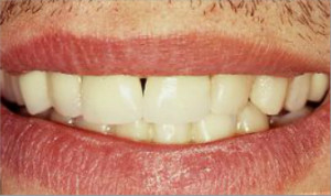 Ortodoncia y rehabilitaciones estéticas
