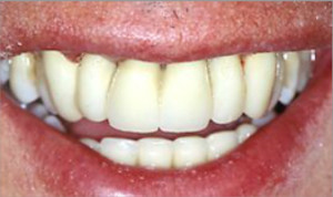 Tratamiento periodontal y estética dental